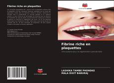 Couverture de Fibrine riche en plaquettes