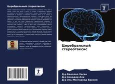 Обложка Церебральный стереотаксис