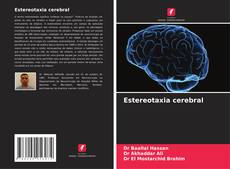 Buchcover von Estereotaxia cerebral