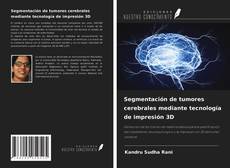Обложка Segmentación de tumores cerebrales mediante tecnología de impresión 3D