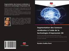 Copertina di Segmentation des tumeurs cérébrales à l'aide de la technologie d'impression 3D