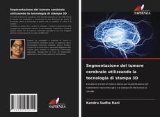 Copertina di Segmentazione del tumore cerebrale utilizzando la tecnologia di stampa 3D