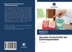 Neueste Fortschritte bei Zahnimplantaten kitap kapağı