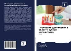 Borítókép a  Последние достижения в области зубных имплантатов - hoz