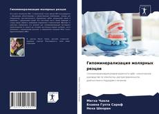 Copertina di Гипоминерализация молярных резцов