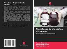 Portada del libro de Transfusão de plaquetas de sangue