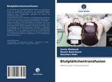 Copertina di Blutplättchentransfusion