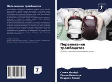 Bookcover of Переливание тромбоцитов