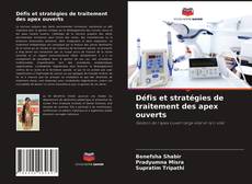 Capa do livro de Défis et stratégies de traitement des apex ouverts 
