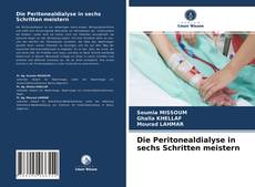 Die Peritonealdialyse in sechs Schritten meistern的封面