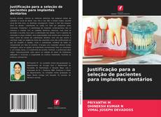 Justificação para a seleção de pacientes para implantes dentários kitap kapağı