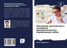Bookcover of Последние достижения в ускорении ортодонтического перемещения зубов