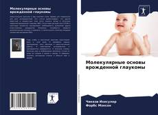Buchcover von Молекулярные основы врожденной глаукомы