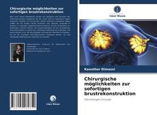 Bookcover of Chirurgische möglichkeiten zur sofortigen brustrekonstruktion