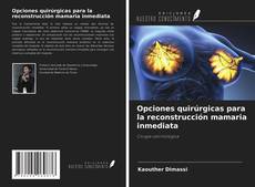 Обложка Opciones quirúrgicas para la reconstrucción mamaria inmediata