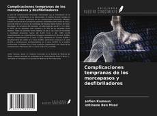 Bookcover of Complicaciones tempranas de los marcapasos y desfibriladores