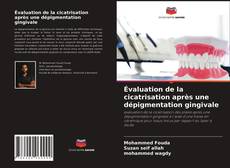 Évaluation de la cicatrisation après une dépigmentation gingivale的封面