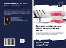Bookcover of Оценка заживления ран после депигментации десны