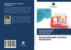 Bookcover of Zahnimplantate und ihre Strukturen