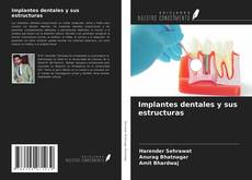 Capa do livro de Implantes dentales y sus estructuras 