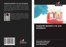 Impianti dentali e le sue strutture的封面