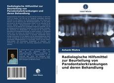 Обложка Radiologische Hilfsmittel zur Beurteilung von Parodontalerkrankungen und deren Behandlung