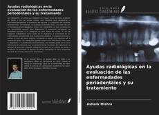 Couverture de Ayudas radiológicas en la evaluación de las enfermedades periodontales y su tratamiento