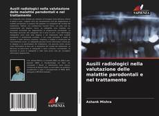 Copertina di Ausili radiologici nella valutazione delle malattie parodontali e nel trattamento