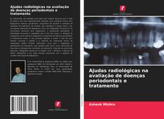 Capa do livro de Ajudas radiológicas na avaliação de doenças periodontais e tratamento 
