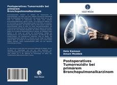 Couverture de Postoperatives Tumorrezidiv bei primärem Bronchopulmonalkarzinom
