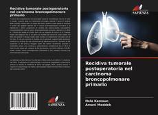 Copertina di Recidiva tumorale postoperatoria nel carcinoma broncopolmonare primario