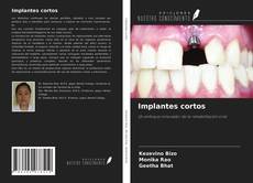 Обложка Implantes cortos