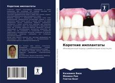 Capa do livro de Короткие имплантаты 