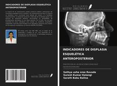 Buchcover von INDICADORES DE DISPLASIA ESQUELÉTICA ANTEROPOSTERIOR