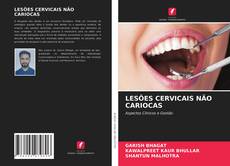 Buchcover von LESÕES CERVICAIS NÃO CARIOCAS