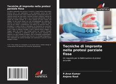 Copertina di Tecniche di impronta nella protesi parziale fissa