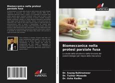 Biomeccanica nella protesi parziale fusa的封面