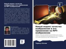 Bookcover of Новый индекс качества изображения и его применение на МРТ-изображении