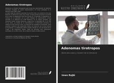 Borítókép a  Adenomas tirotropos - hoz