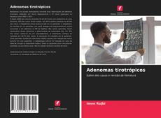 Couverture de Adenomas tirotrópicos