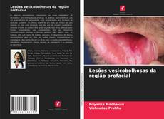 Couverture de Lesões vesicobolhosas da região orofacial