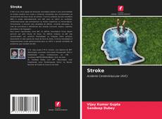 Bookcover of Stroke