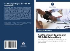 Couverture de Rechtzeitiger Beginn der MDR-TB-Behandlung