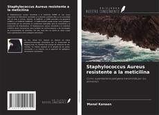 Bookcover of Staphylococcus Aureus resistente a la meticilina