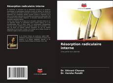 Bookcover of Résorption radiculaire interne