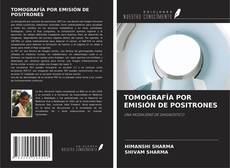Bookcover of TOMOGRAFÍA POR EMISIÓN DE POSITRONES
