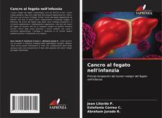 Cancro al fegato nell'infanzia的封面