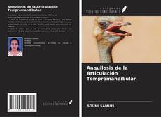 Copertina di Anquilosis de la Articulación Tempromandibular