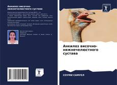 Обложка Анкилоз височно-нижнечелюстного сустава