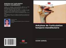 Buchcover von Ankylose de l'articulation temporo-mandibulaire
